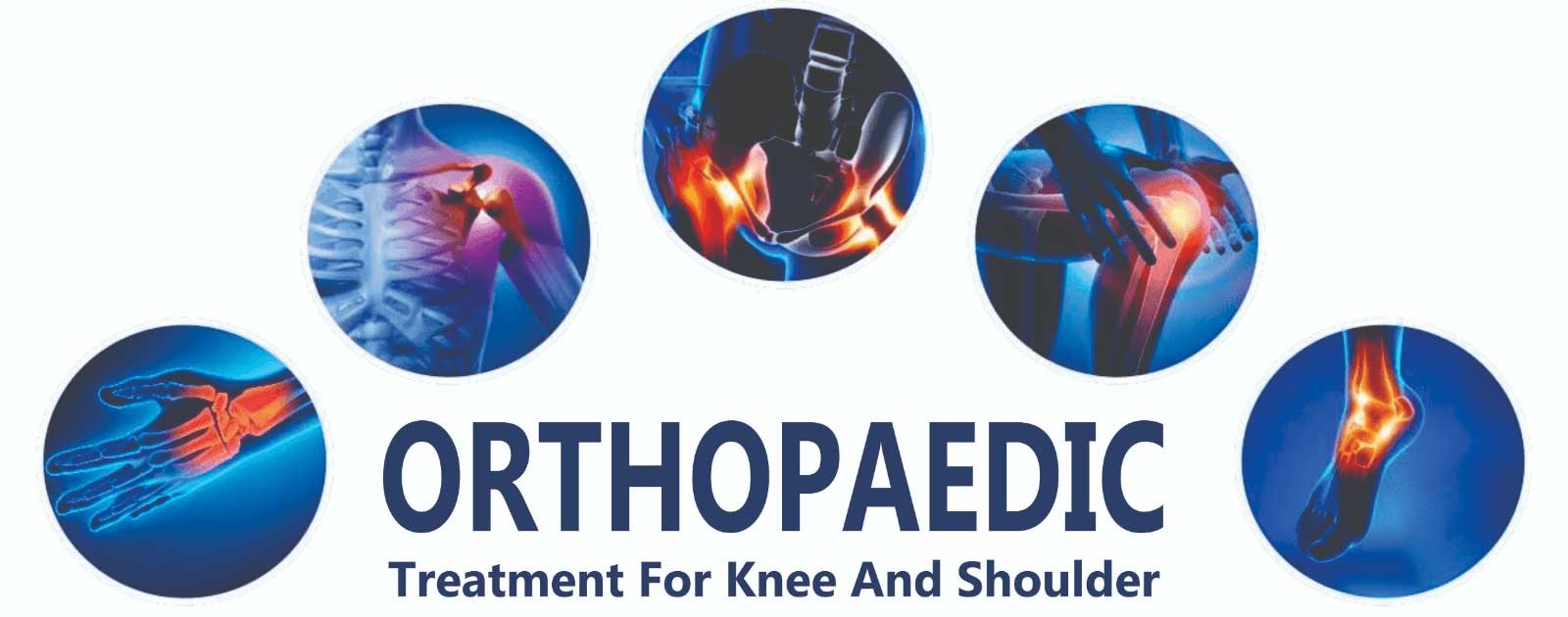 orthopedic treatment for knees